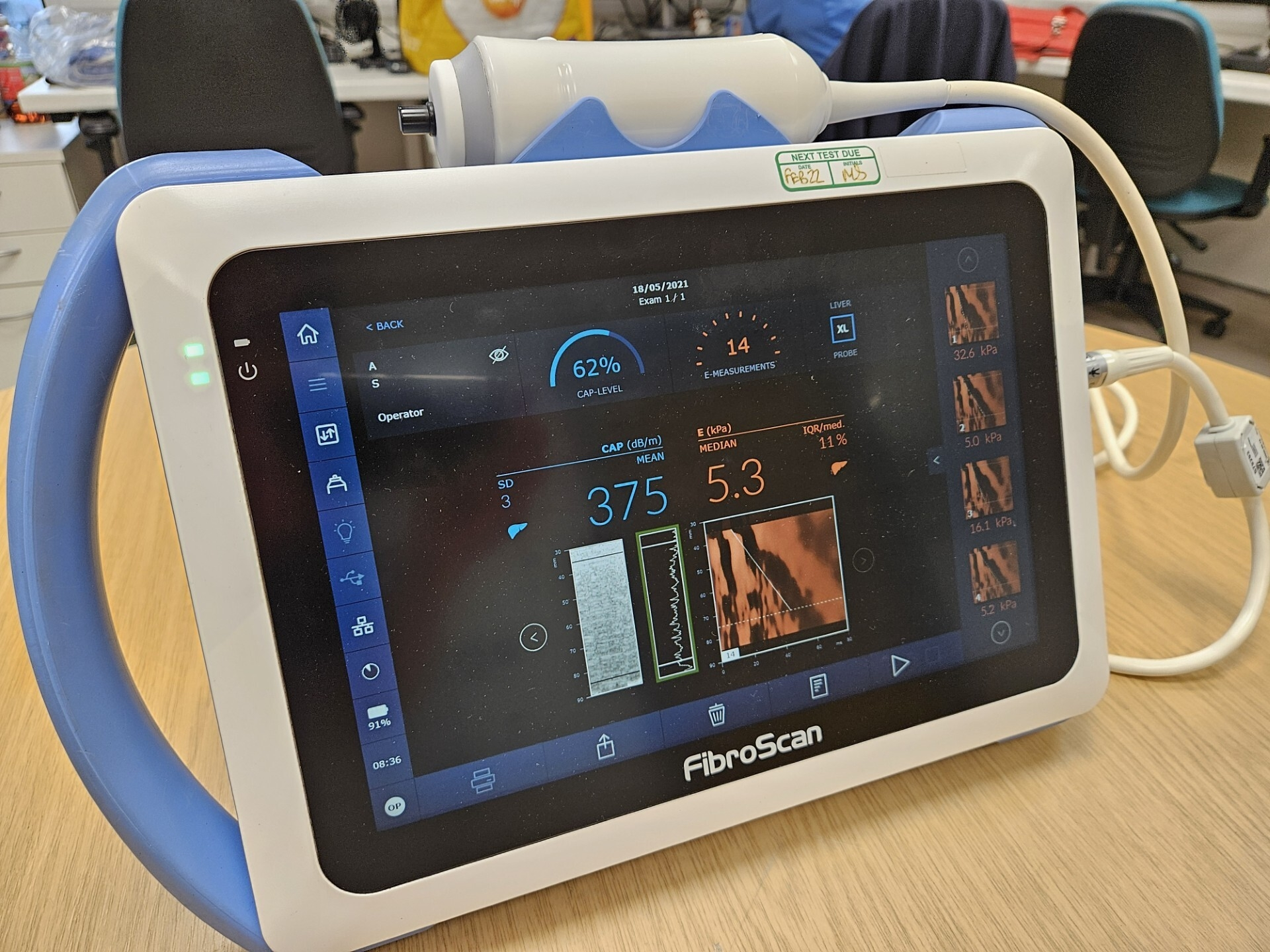 2870ada5 b24f 45fd b31b 0f768a41381e